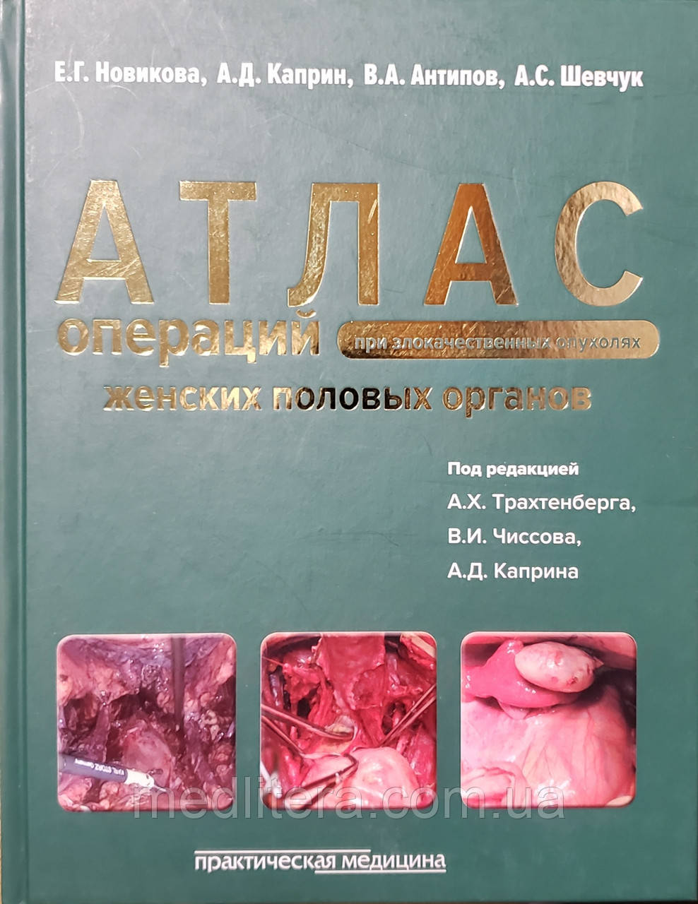 Новікова Е. Р. Атлас операцій при злоякісних пухлинах жіночих статевих органів