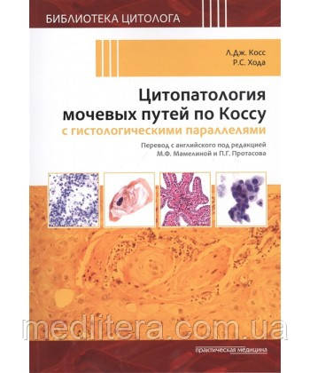 Косс Л. Дж. Цитопатология сечових шляхів за Коссу з гістологічними паралелями