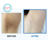 Відбілюючий пілінг-пед з кислотами для тіла  Celimax One Step Body Underarms  Brightening Pad, фото 7