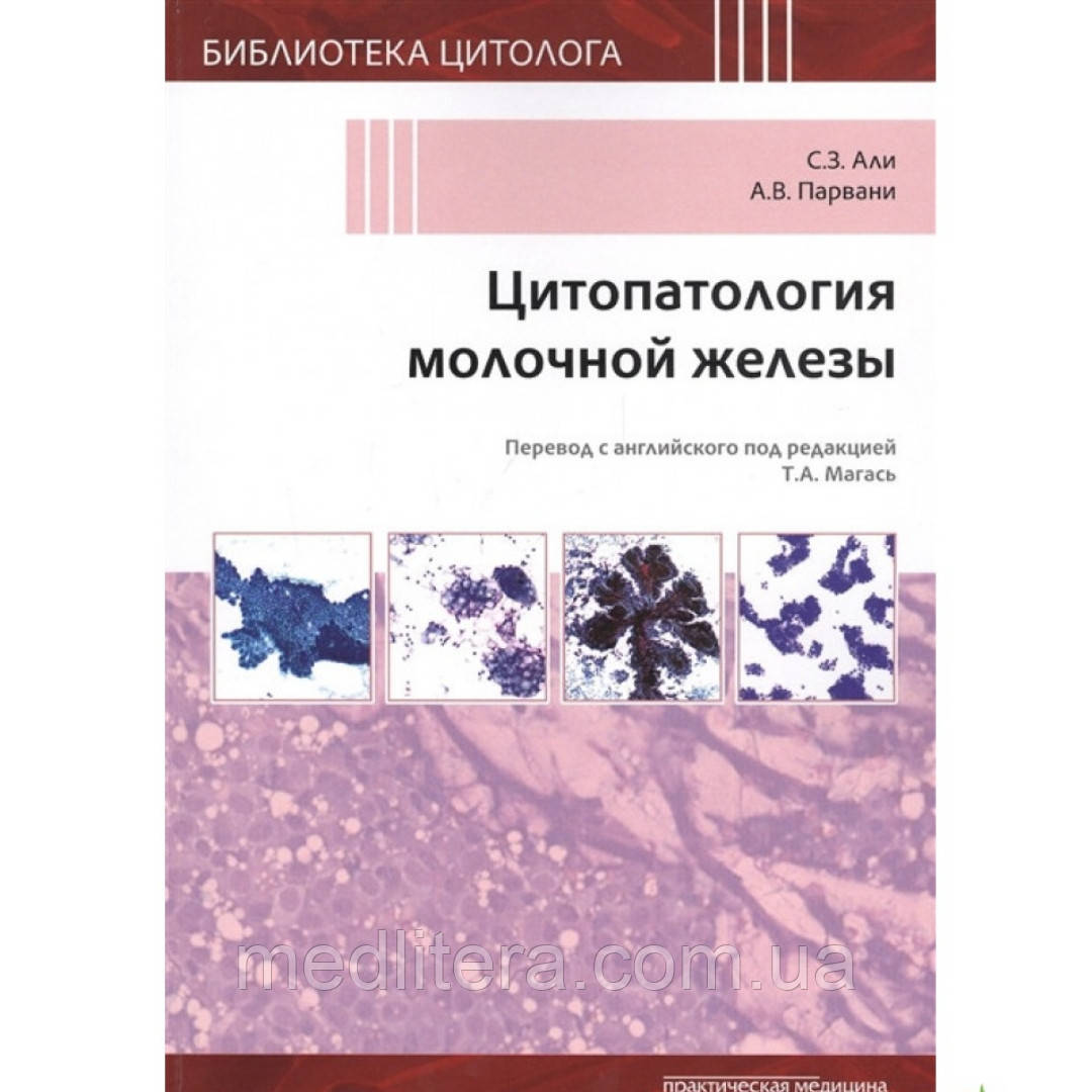 С. З. АЛІ , А. В. ПАРВАНИ. ЦИТОПАТОЛОГИЯ МОЛОЧНОЇ ЗАЛОЗИ 2020р