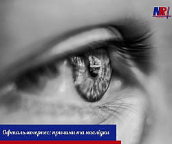 Офтальмогерпес - причини та наслідки