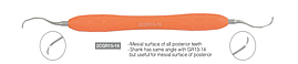 Кюрета Gracey 2CGR 15-16, стандартна, силіконова ручка, двостороння. Для роботи на медиальній поверхні задніх