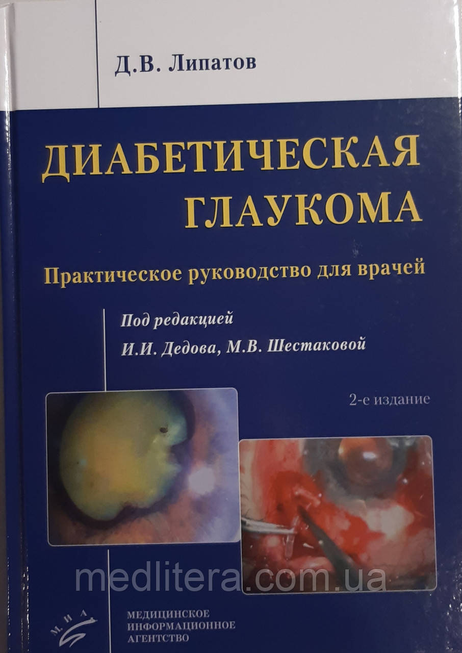 Ліпатов Д. В. Діабетична глаукома 2019г 2-ге видання