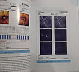 Ліпатов Д. В. Діабетична глаукома 2019г 2-ге видання, фото 4