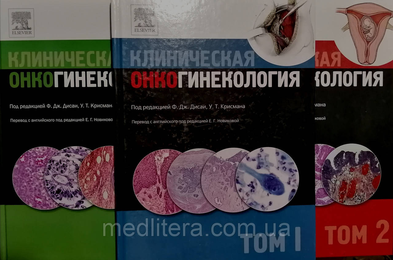 Дісаї Ф. Дж., Крісман У. Т. под ред. Новікової Е. Р. Клінічна онкогінекологія в 3-х томах (ціна за комплект)