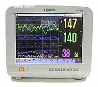 Монитор фетальный для двойни BF500 Медаппаратура
