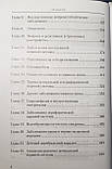Шток,  Левін Довідник з формулювання клінічного діагнозу хвороб нервової системи 3 видання, фото 4