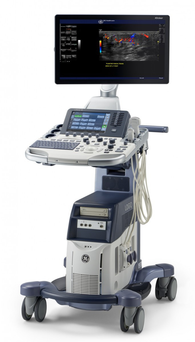 УЗИ аппараты GE Healthcare Logiq S8 XDclear - фото 2 - id-p1408364990