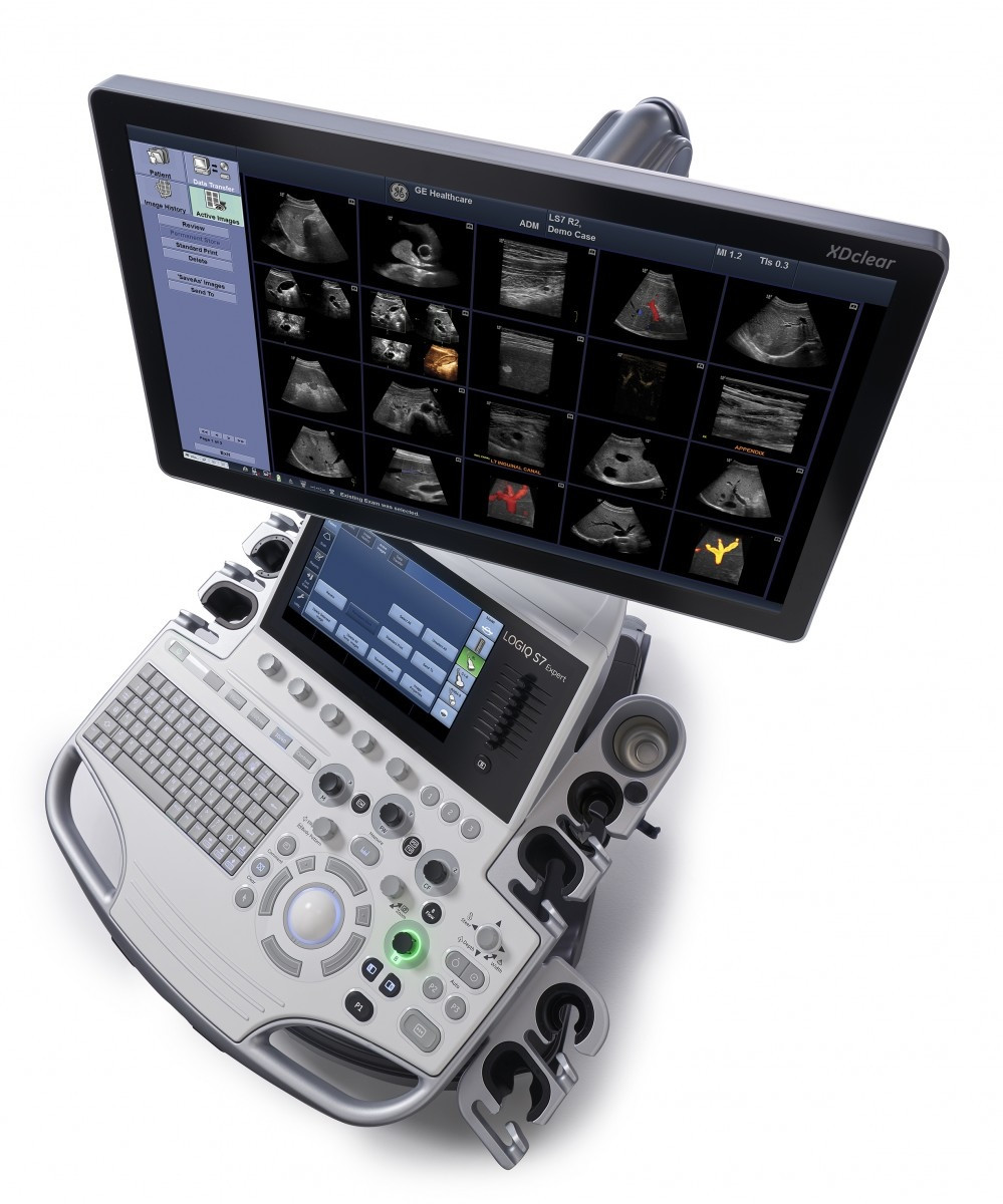 УЗД апарати GE Healthcare LOGIQ S7 XDclear