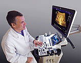 УЗД апарати GE Healthcare LOGIQ F6/F8, фото 3