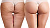 Sesderma Celulex Anti-Cellulite Gel Антицелюлітний Гель Від Целюліту 200 мл Оригінал Іспанія Доставка з ЄС, фото 2