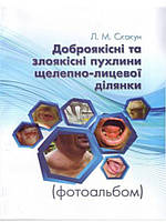 Доброякісні та злоякісні пухлини щелепно-лицевої ділянки Фотоальбом. Скакун Л.М.