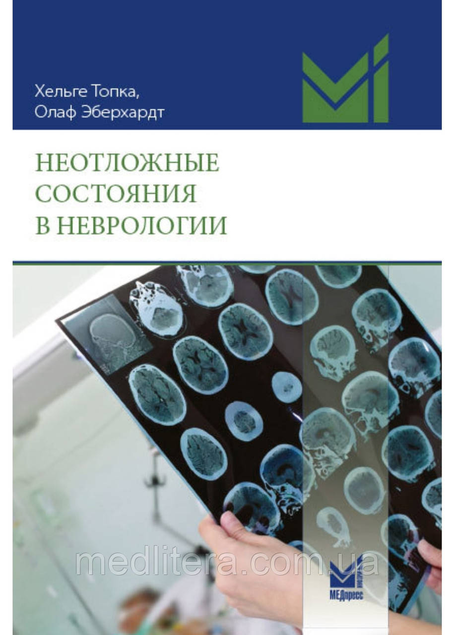 Топка Х., Эберхардт О. Невідкладні стани в неврології 2021р., фото 1