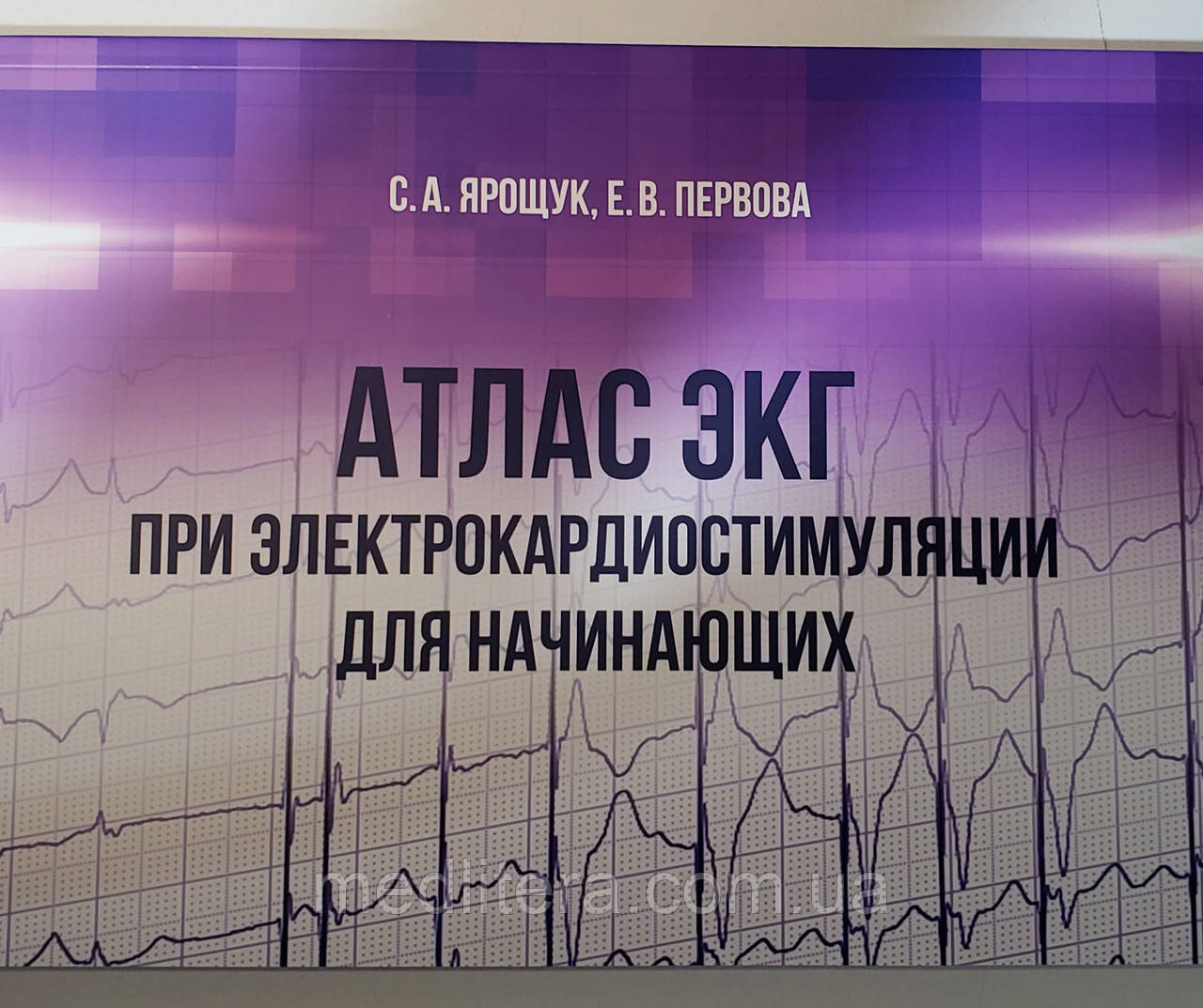 Атлас ЕКГ при електрокардіостимуляції. Для початківців Ярощук С. А., Первова Е. В. 2020 р.