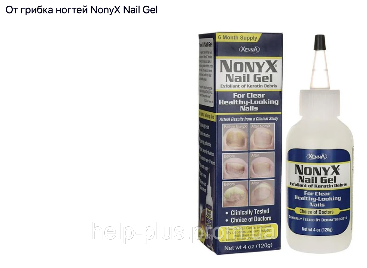 Nonyx Nail Gel Противогрибковый гель для ногтей ног и рук . США, цена 1290 грн — (ID#1411589475) Nonyx Nail Gel Противогрибковый гель для ногтей ног и рук . США, цена 1290 грн — (ID#1411589475)