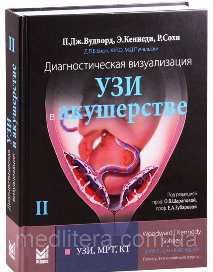 Вудворд Підлоги Дж. Діагностична візуалізація. УЗД в акушерстві. Том 2. рік 2021