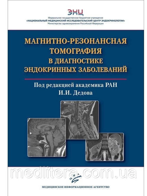 Магнітно-резонансна томографія в діагностиці ендокринних 2021