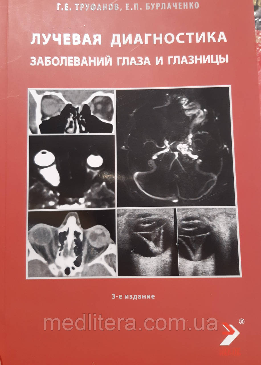 Труфанов Р. Е. Променева діагностика захворювань ока і очниці 2020р, фото 1