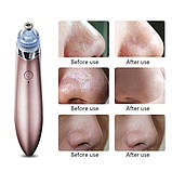 Вакуумний апарат для чищення пір Beauty Skin Care Specialist XN-8030 Краща ціна!, фото 6