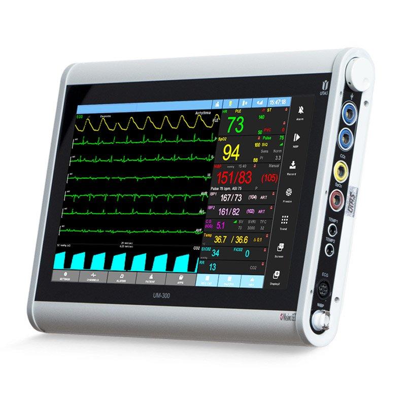 Монітор пацієнта ЮМ 300 - 15, фото 1