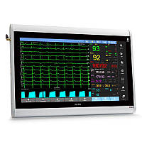 Монітор пацієнта ЮМ 300 - 20