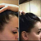 Жіночий шампунь проти випадіння волосся з арганою Unice, 400 мл, фото 4