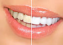 Відбілююча зубна паста Crest 3D White Whitening Therapy Charcoal 116 грам, фото 5