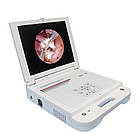 Портативний ендоскоп з екраном медичний HC-I040I Full HD, фото 5