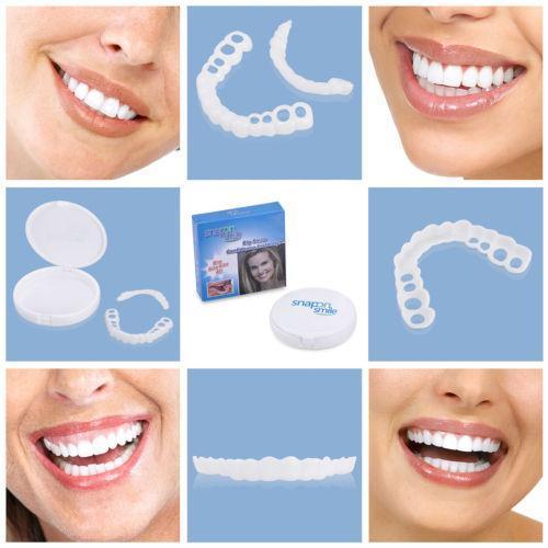 Съемные виниры Veneers Snap-on smile | Виниры для зубов! Лучший товар - фото 6 - id-p1420765659