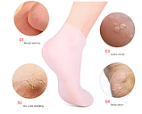 Силіконові шкарпетки для догляду за шкірою ніг (1 пара гелевих спа-шкарпетків), фото 3