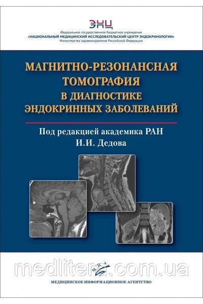 Воронцов А. В. Магнітно-резонансна томографія в діагностиці ендокринних захворювань РАН В. І. Дєдова. 2021