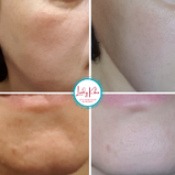 Крем з муцином равлика і бджолиною отрутою  Benton Snail Bee High Content Steam Cream, 50g, фото 5