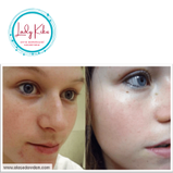 Крем з муцином равлика і бджолиною отрутою  Benton Snail Bee High Content Steam Cream, 50g, фото 6