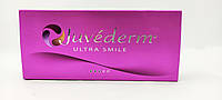 Juvederm Ultra Smile (1*0.55ml) (Ювідерм Ультрасмайл)