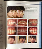 Вільям Дж. Кларк Ортодонтичне лікування парними блоками 2019 рік, фото 2