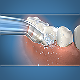 Пародонтологічна насадка Waterpik PP-100E, фото 4