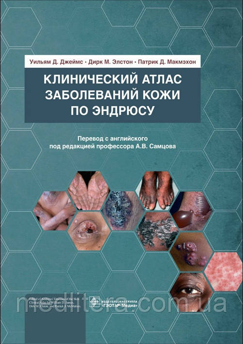 Джеймс, Елстон, Макмехон Клінічний атлас захворювань шкіри за Ендрюсу 2021 рік під ред Самцова