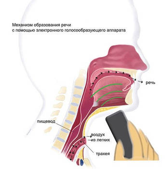 ГОЛОСООБРАЗУЮЩИЕ АПАРАТИ