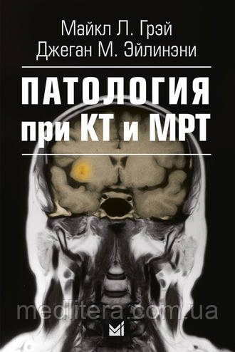 Грей М. Л. Патологія при КТ і МРТ 2-е видання 2017 рік