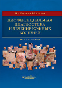 Потекаев Н. Н. Диференціальна діагностика та лікування шкірних хвороб