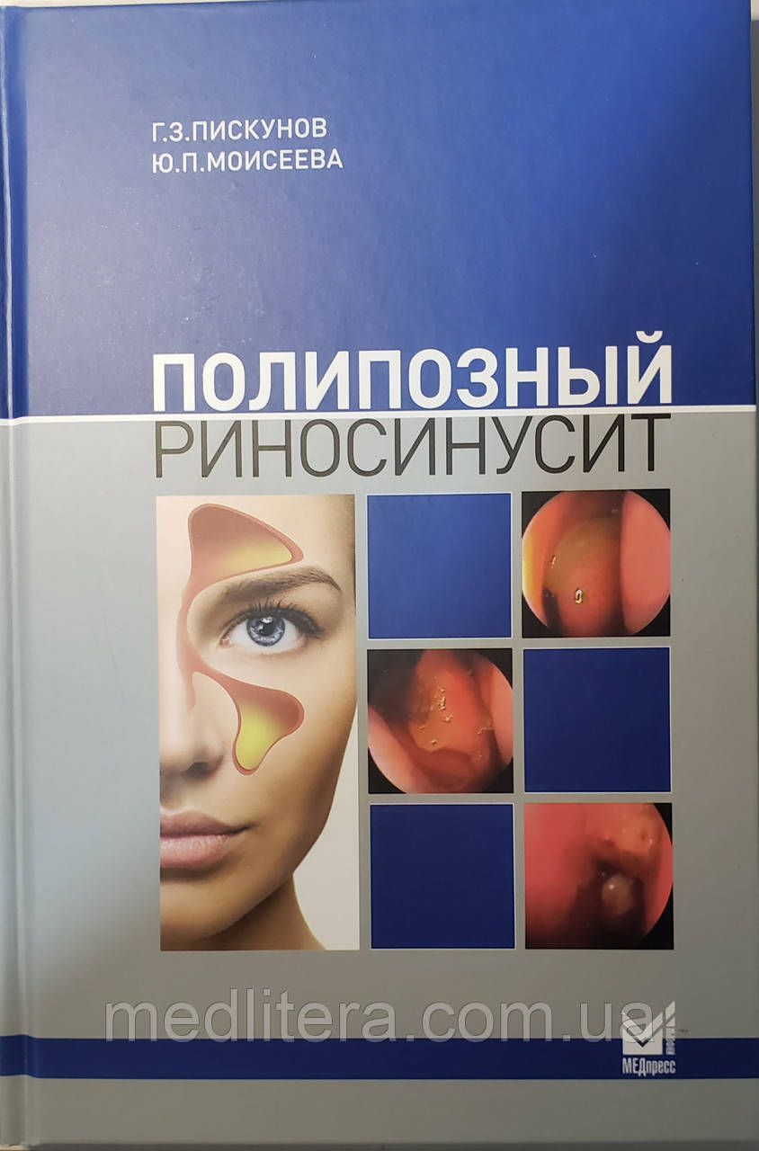 Піскунов Р. З. Поліпозний риносинусит 2-е видання доповнене 2021 рік