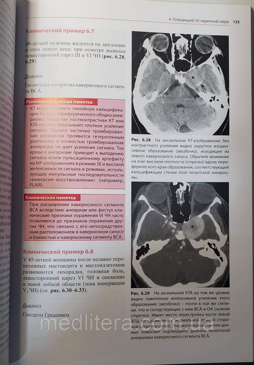 Біндер Д. К. Черепні нерви: анатомія, патологія, візуалізація - фото 3 - id-p67691497