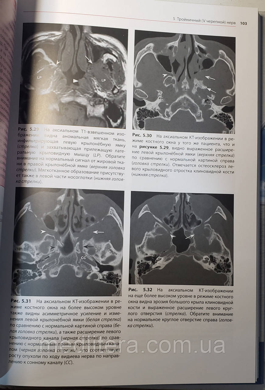 Биндер Д.К. Черепные нервы: анатомия, патология, визуализация - фото 4 - id-p67691497