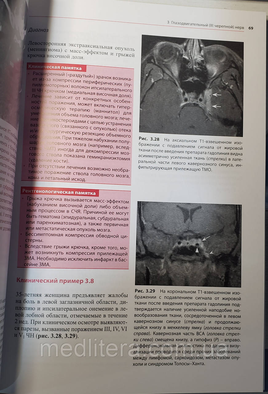Биндер Д.К. Черепные нервы: анатомия, патология, визуализация - фото 5 - id-p67691497