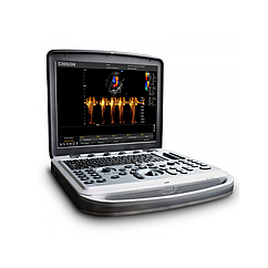 Портативний ультразвуковий апарат експертного класу Chison SonoBook 6