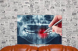 Стоматологія. Челюсть. Рентген. Зуби. 40х60 см. Картина на полотні.