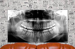 Стоматологія. Челюсть. Рентген. Зуби. 50х90 см. Картина на полотні.