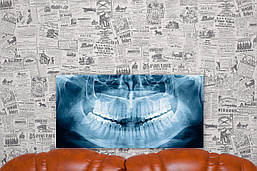 Стоматологія. Челюсть. Рентген. Зуби. 30х60 см. Картина на полотні.
