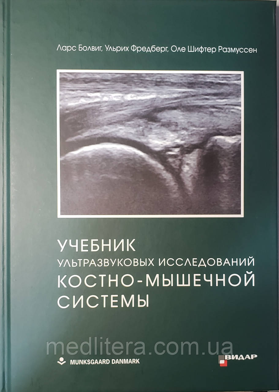 Підручник ультразвукових досліджень кістково-м'язової системи. Л. Болвиг, У. Фредберг, 2020р.