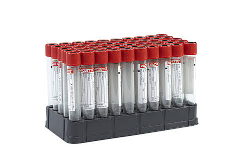 Пробірка Vacuette для APRF 9 мл з активатором згортання крові (50 шт.), фото 2